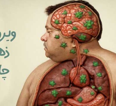 ویروس ذهنی چاقی