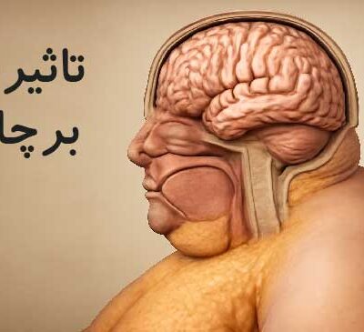 تاثیر مغز در چاقی